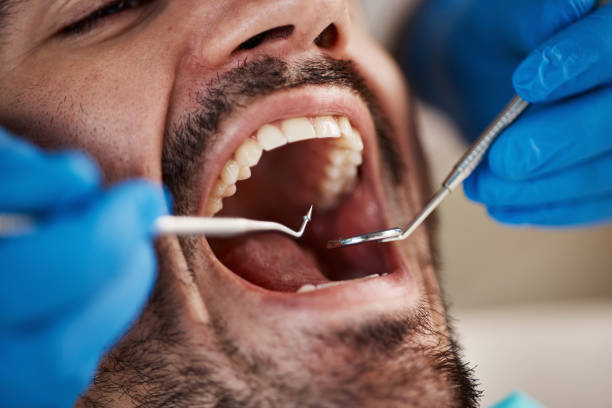Best Broken or Chipped Tooth Repair in Pearland, TX